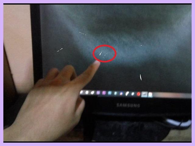 Layar Laptop Bercak Putih